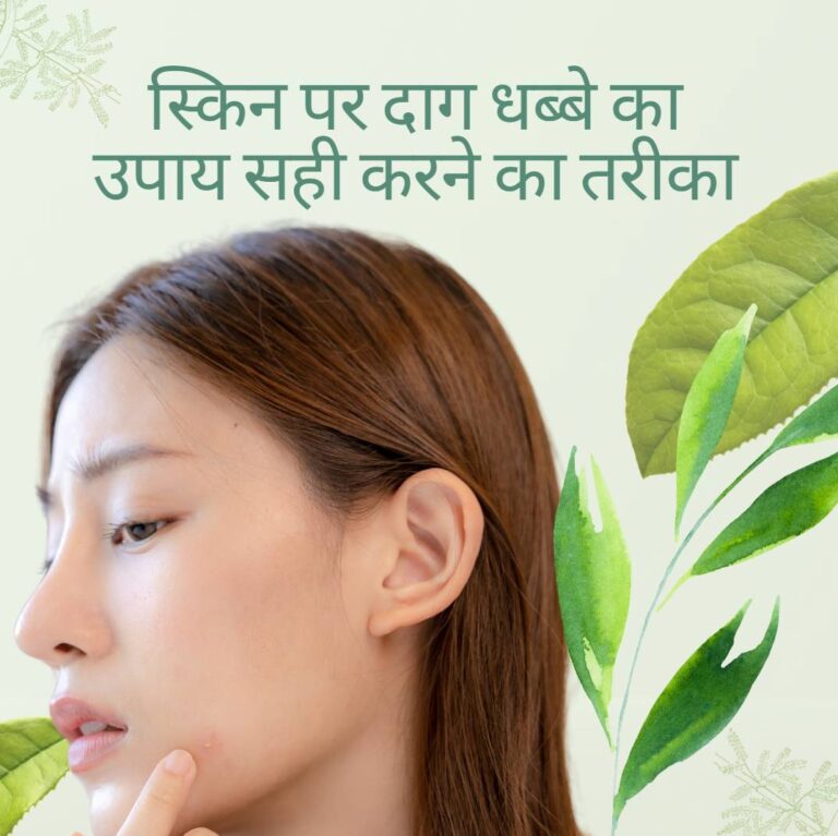 चेहरे पर दाग-धब्बे जाने जड़ से मिटने के उपाय Gharelu upchaar Desi ayurveda Dawai